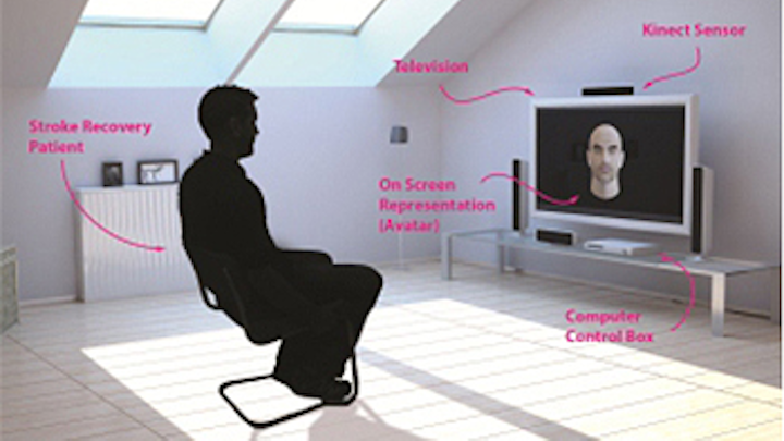 Kinect aids rehabilitation of stroke patients