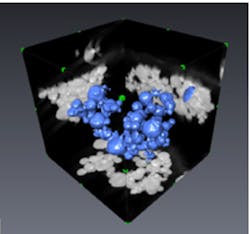Algorithms lower the dose of CT scans Algorithms lower the dose of CT scans
