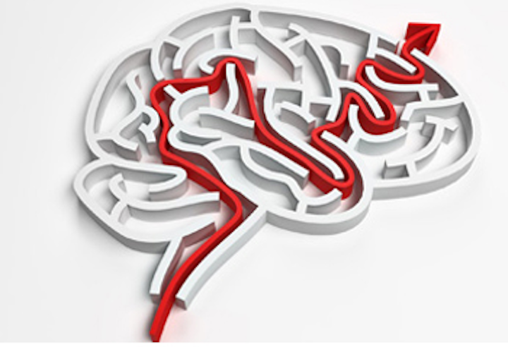 Software automates brain image analysis