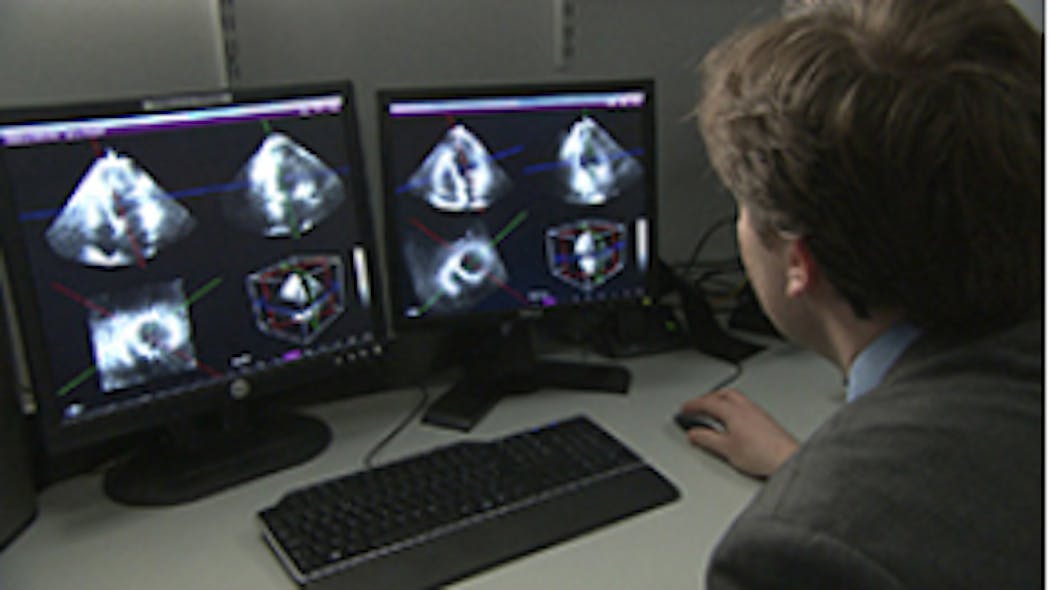 Software enhances ultrasound images