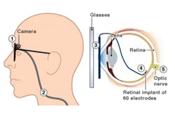 Farsighted engineer gives second sight to the blind Farsighted engineer gives second sight to the blind