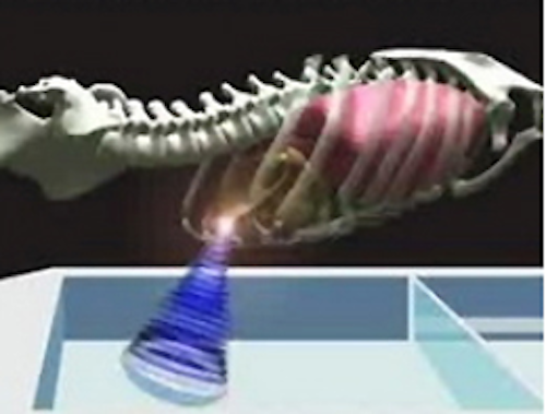 Treating moving tumors with ultrasound
