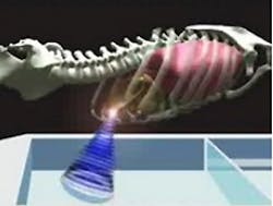 Treating moving tumors with ultrasound Treating moving tumors with ultrasound