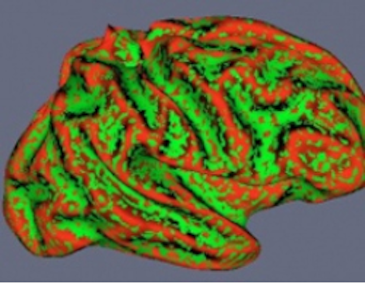 Scans identify issues in child development