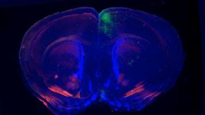 Content Dam Vsd Online Articles 2013 04 3d Mouse Brain Reconstruction