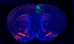 Content Dam Vsd Online Articles 2013 04 3d Mouse Brain Reconstruction Content Dam Vsd Online Articles 2013 04 3d Mouse Brain Reconstruction
