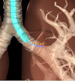 New software keeps X-ray exposure down New software keeps X-ray exposure down