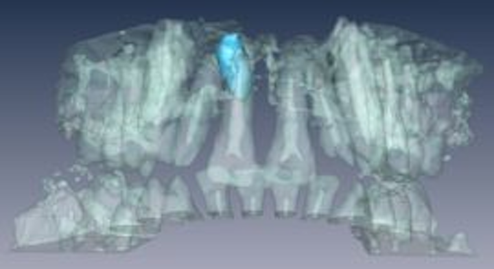 Content Dam Vsd Online Articles 2013 07 Dentist Mri