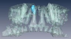 Content Dam Vsd Online Articles 2013 07 Dentist Mri Content Dam Vsd Online Articles 2013 07 Dentist Mri