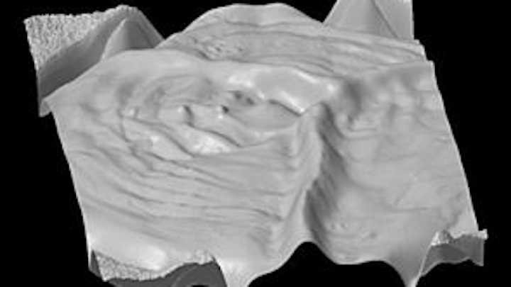 Content Dam Vsd Online Articles 2013 08 3d Colonoscopy