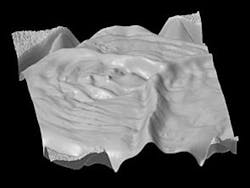 Content Dam Vsd Online Articles 2013 08 3d Colonoscopy Content Dam Vsd Online Articles 2013 08 3d Colonoscopy