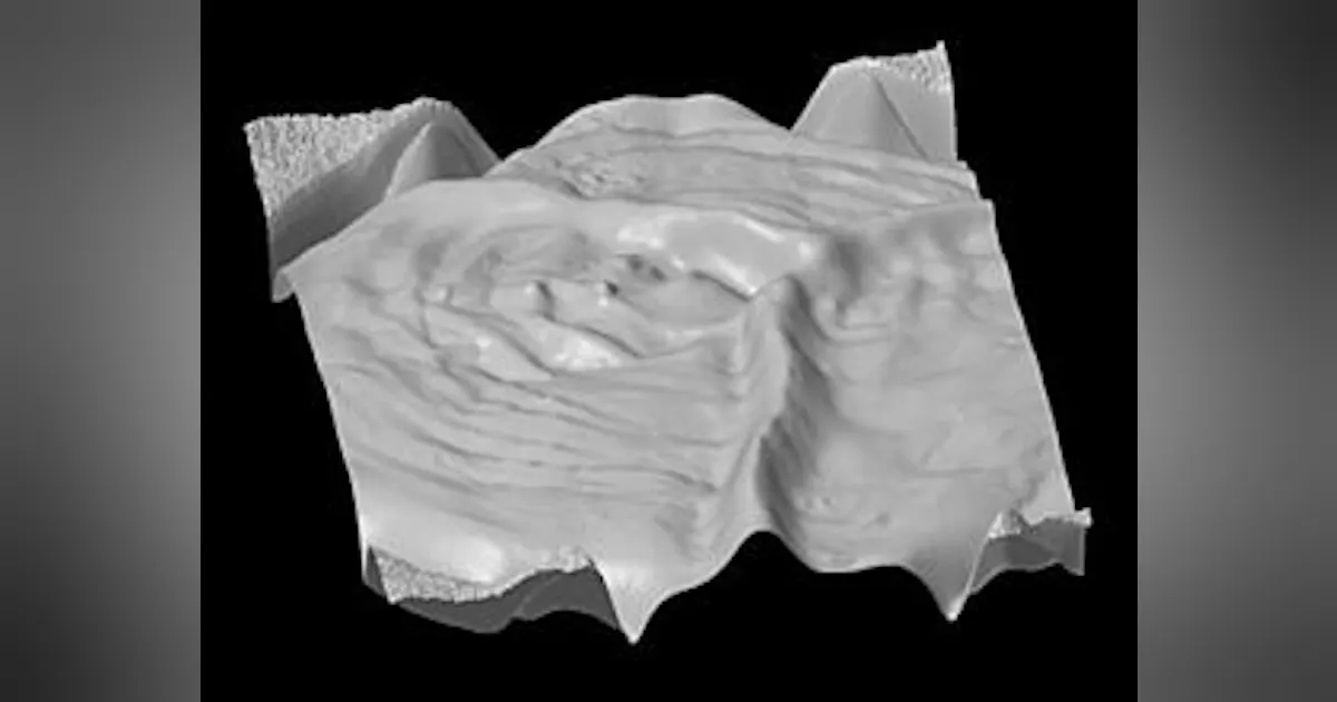 Colonoscopy Python 3d 3D imaging technology could improve colonoscopy procedures | Vision ...
