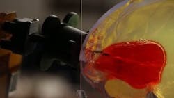 Content Dam Vsd Online Articles 2013 08 Blood Clots Copy Content Dam Vsd Online Articles 2013 08 Blood Clots Copy