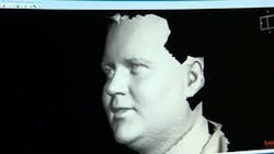 Content Dam Vsd Online Articles 2013 09 3d Facial Imaging Content Dam Vsd Online Articles 2013 09 3d Facial Imaging
