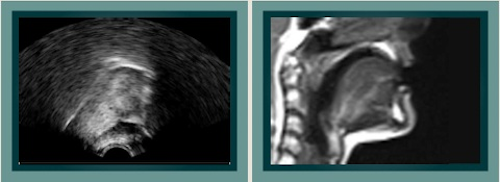 Content Dam Vsd Online Articles 2013 10 3d Imaging Speech