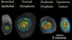 Slide6image Slide6image