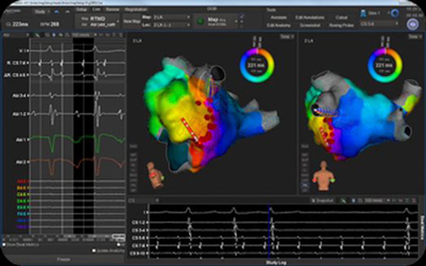 (Slideshow) Five interesting applications of imaging software ...