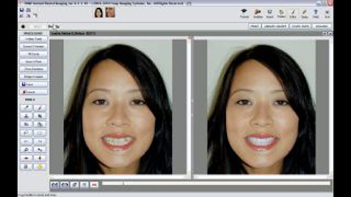 Slide 5 Image
