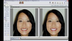 Slide 5 Image Slide 5 Image