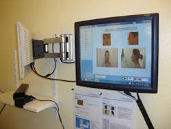 Snap Intubation 1302vsd Snap Intubation 1302vsd