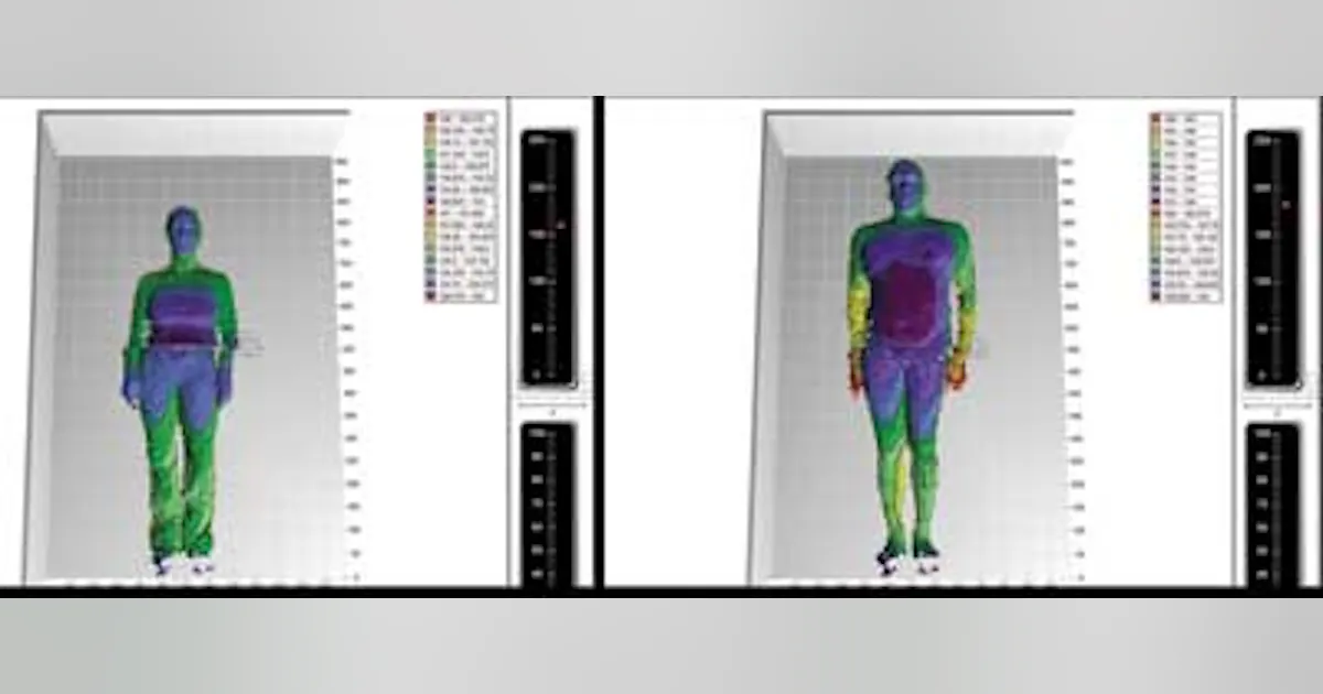 Kinect could help medics estimate radiation dose from CT scanner ...