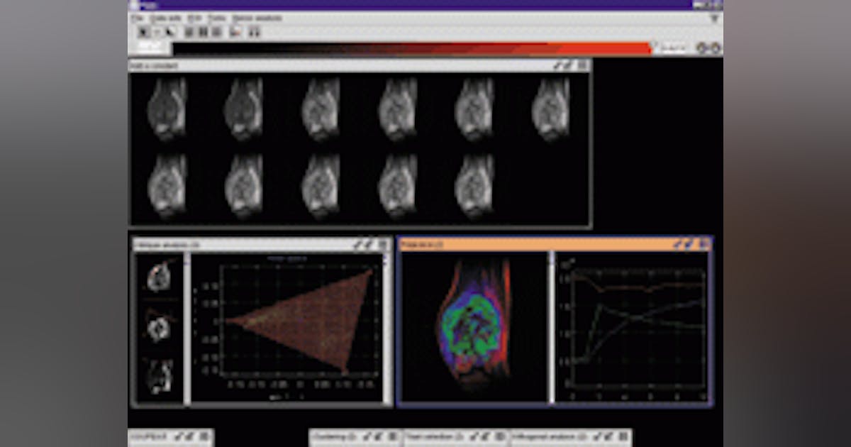 SPOTLIGHT ON ADVANCED TECHNOLOGY: Software vendors endorse java ...