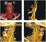 Th 0200edit Th 0200edit