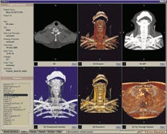 Th 0200feat1 4 Th 0200feat1 4