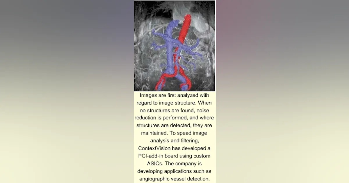 ASIC-based imaging enhances MRI analysis | Vision Systems Design