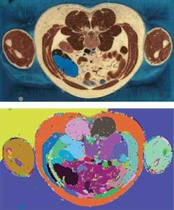 Th 0511vsd Productfocus04 Th 0511vsd Productfocus04