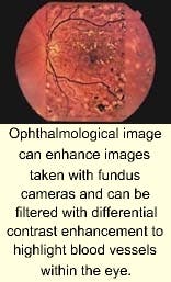 Th 1000news3 Th 1000news3