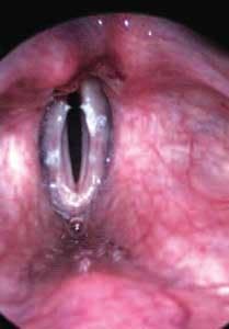 Th Spot Fig1 0905vsd Th Spot Fig1 0905vsd