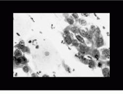 Th Vsd50779 25 Th Vsd50779 25