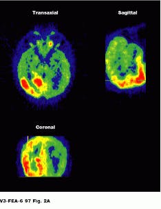 Th Vsd51026 24 Th Vsd51026 24