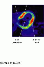 Th Vsd51026 25 Th Vsd51026 25