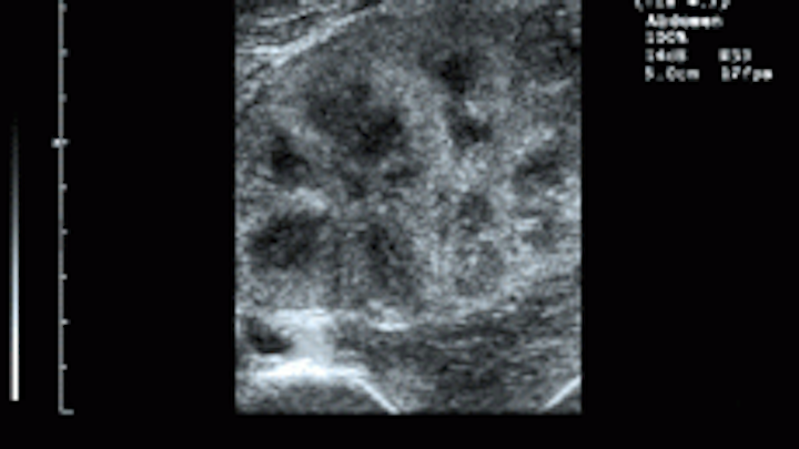 Th Vsd51083 21