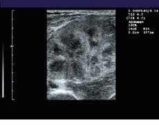 Th Vsd51083 21 Th Vsd51083 21