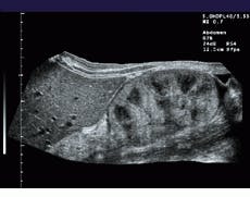 Th Vsd51083 22 Th Vsd51083 22