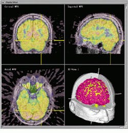 Th Vsd51110 22 Th Vsd51110 22