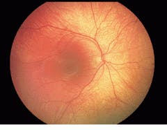 Th Vsd51199 46 Th Vsd51199 46