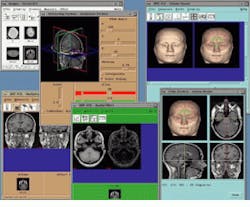 Th Vsd51356 32 Th Vsd51356 32