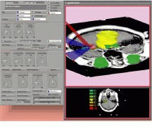 Th Vsd51356 33 Th Vsd51356 33