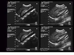 Th Vsd51535 32 Th Vsd51535 32