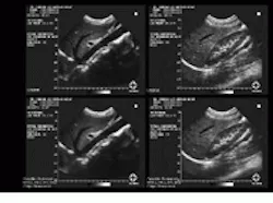 Th Vsd51535 32 Th Vsd51535 32