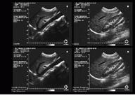 Th Vsd51535 32 Th Vsd51535 32