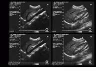 Th Vsd51535 32 Th Vsd51535 32