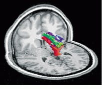 Th Vsd51580 76 Th Vsd51580 76