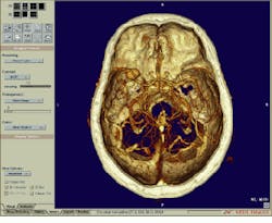 Th Vsd51713 25 Th Vsd51713 25