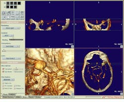 Th Vsd51713 26 Th Vsd51713 26