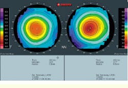 Th Vsd51849 34 Th Vsd51849 34